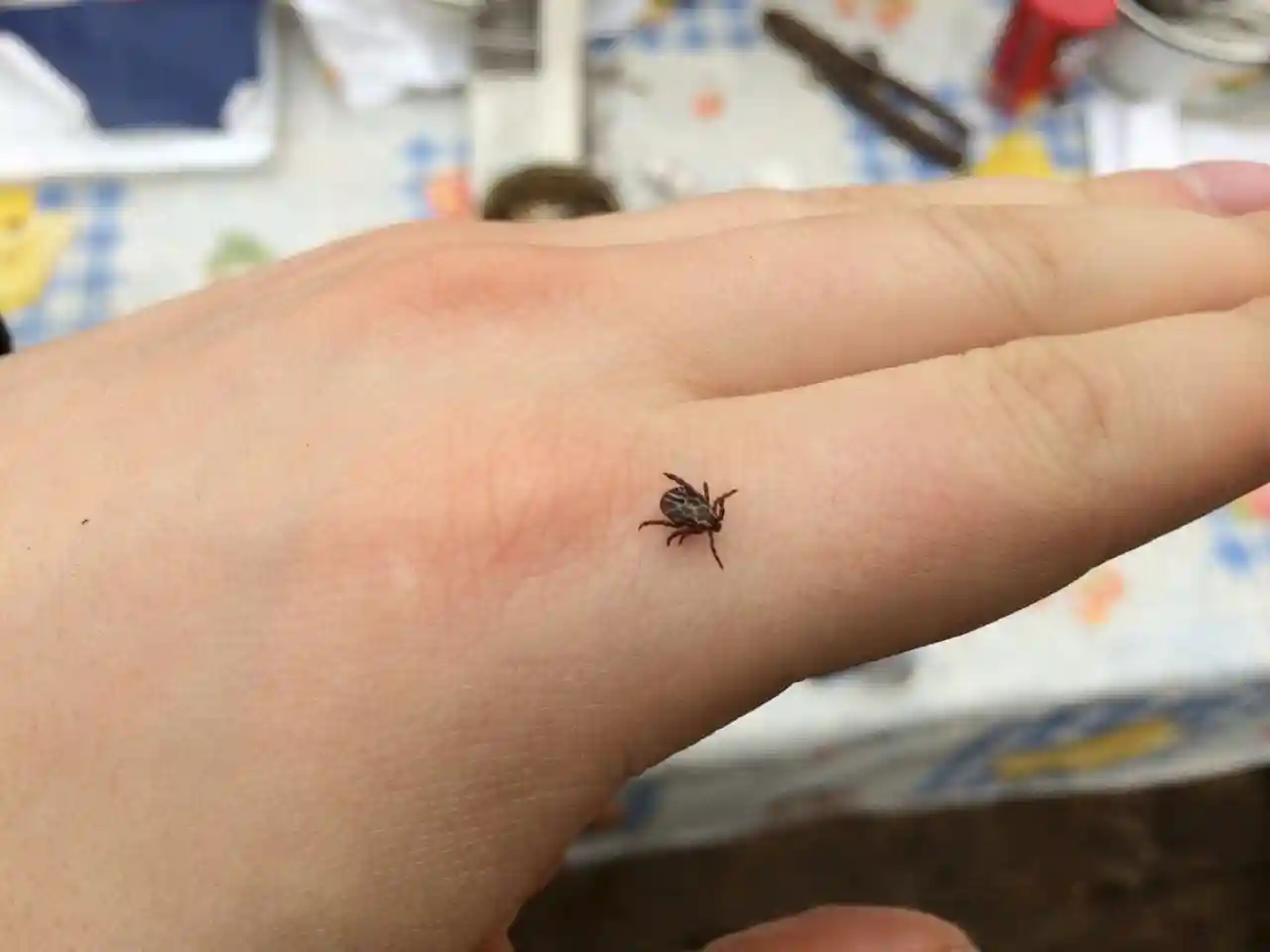 Как вытащить клеща и что с ним делать?